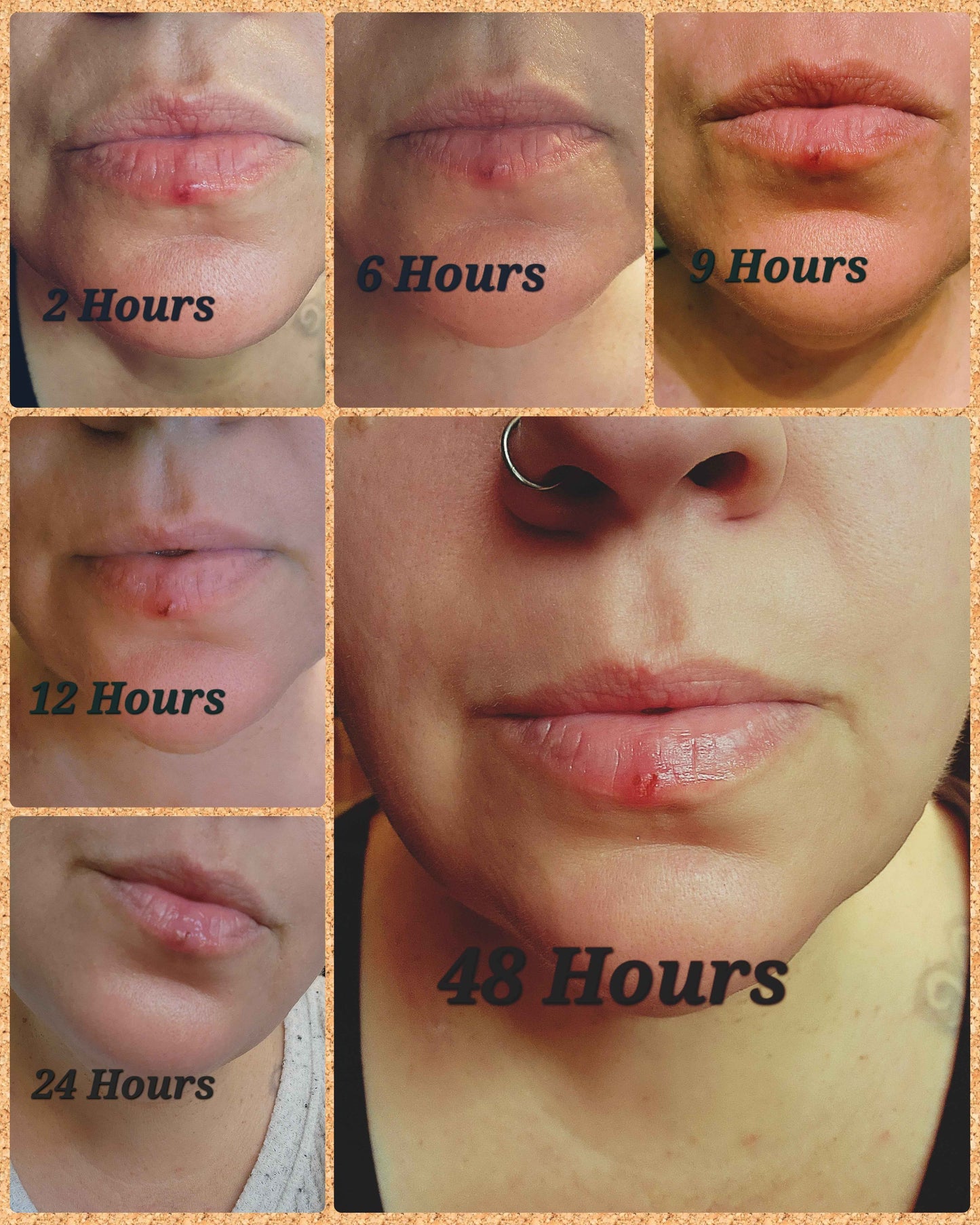 Sore Loser | Natural Cold Sore & Shingles Remedy | Cooling Comfort | 2 Oz Treatment Pump