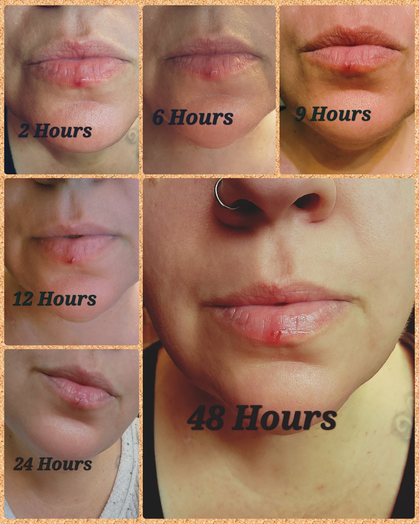 Sore Loser | Natural Cold Sore & Shingles Remedy | Cooling Comfort | 2 Oz Treatment Pump