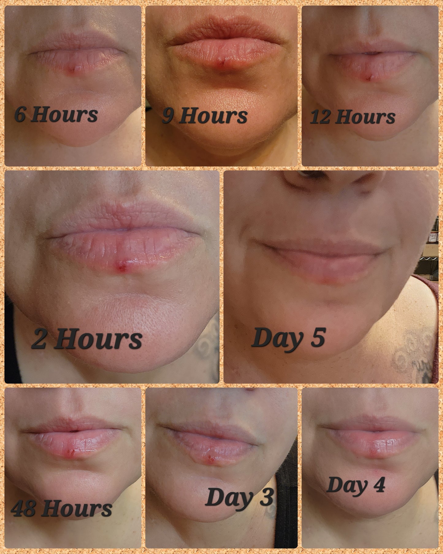 Sore Loser | Natural Cold Sore & Shingles Remedy | Cooling Comfort | 2 Oz Treatment Pump